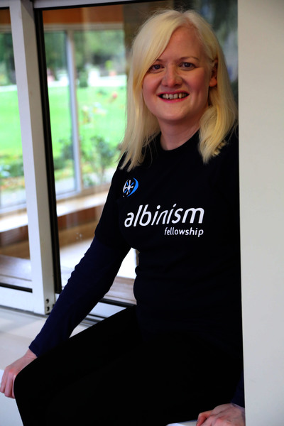 albinism genetics disorder