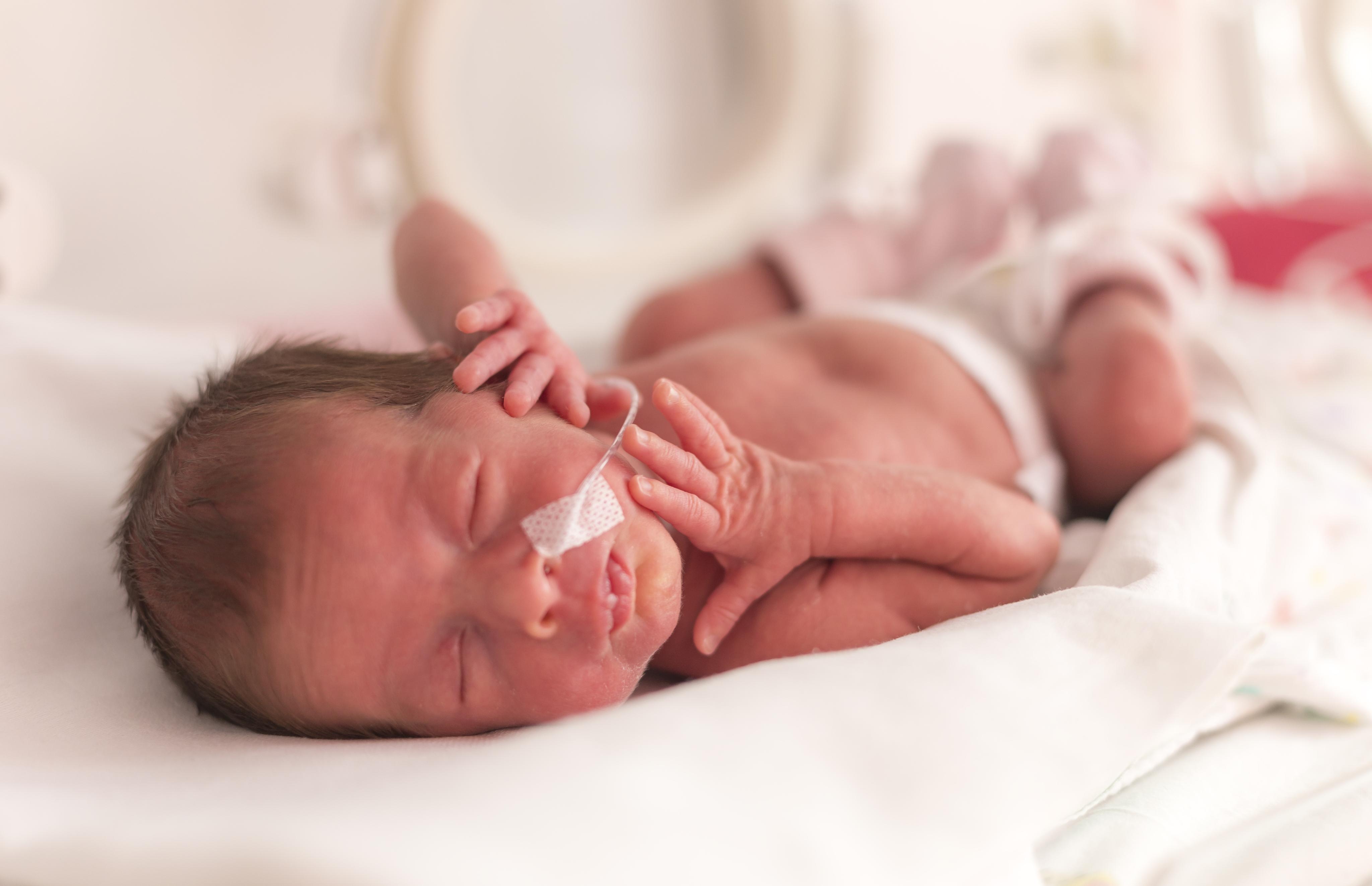Premature Babies: MedlinePlus