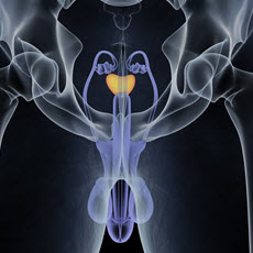 Prostate cancer genetic link