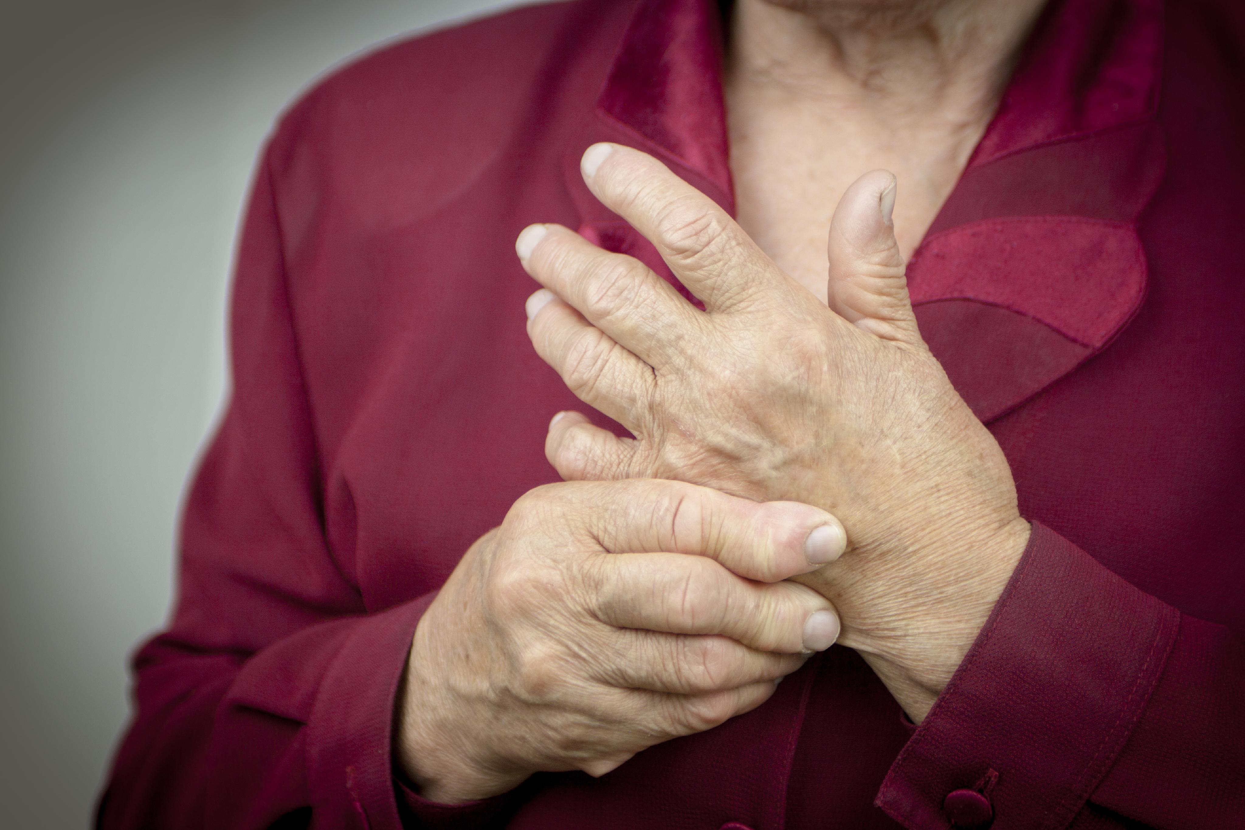 Artritis en las manos: Síntomas, tratamiento y remedios caseros