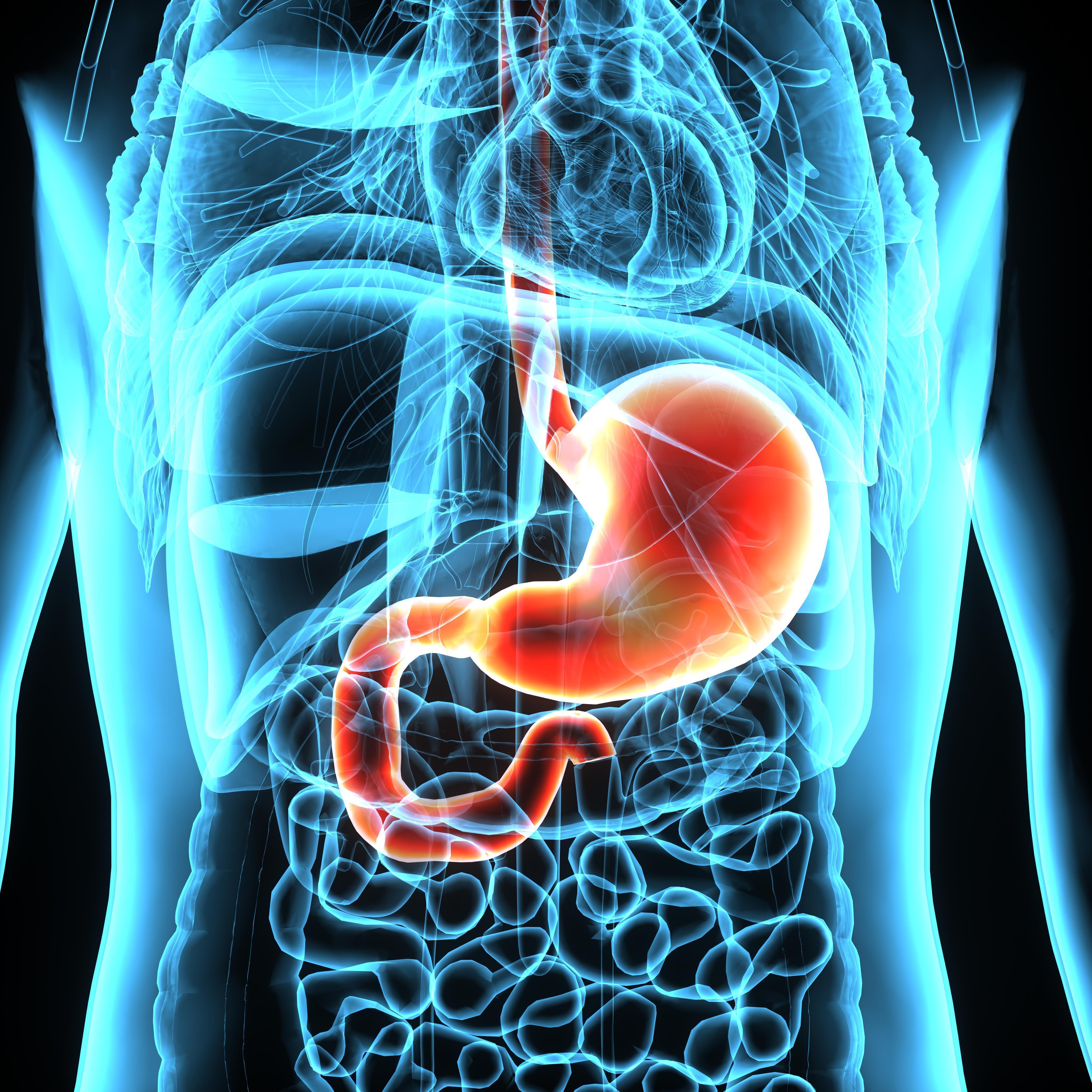 What Is Stomach Cancer? - NCI