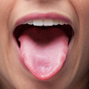 Tongue Disorders