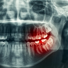 Trastornos dentales