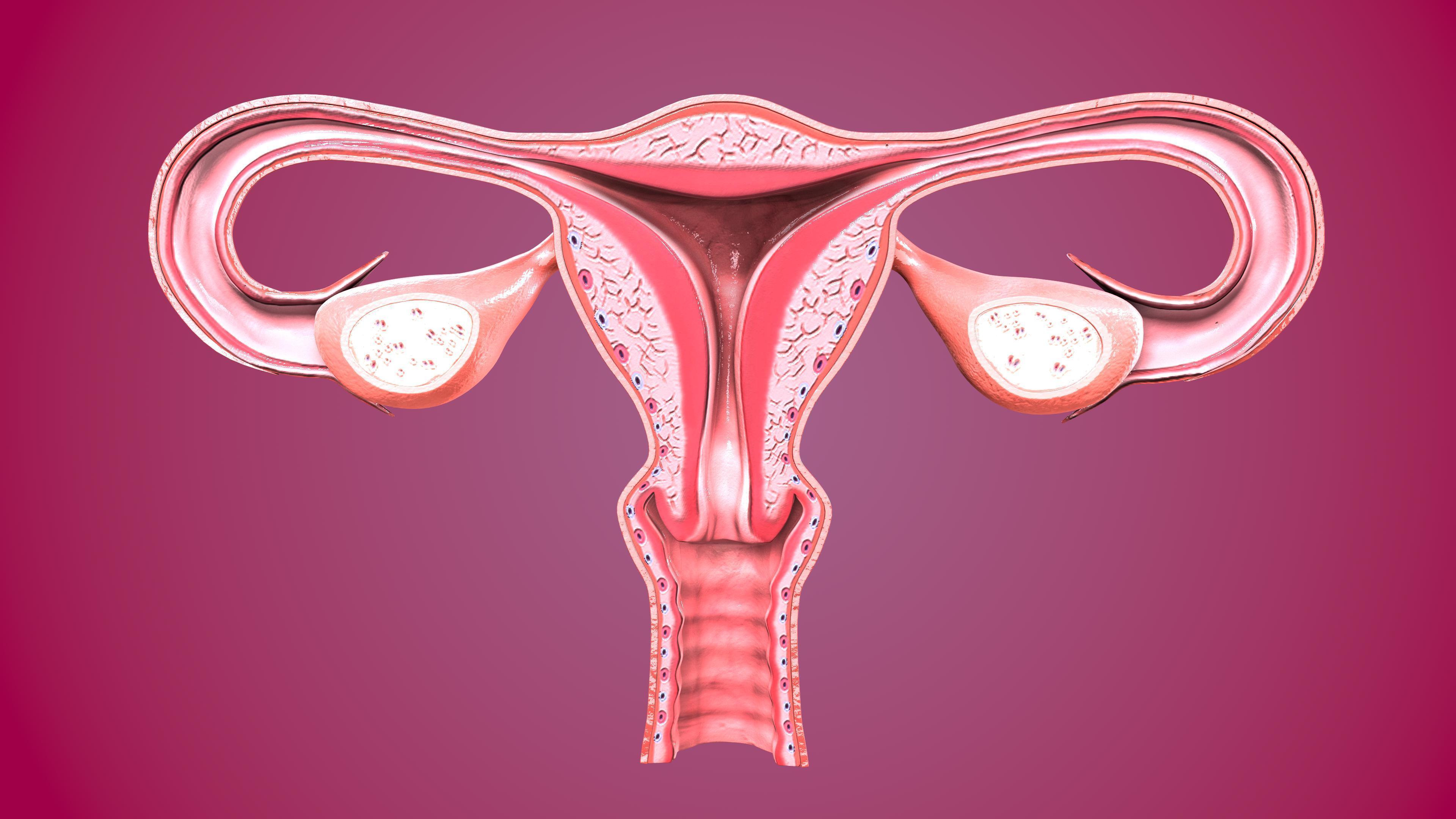 Vaginal Bleeding, Uterine Fibroids