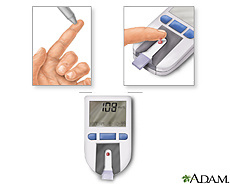 Illustration of a blood test using a blood glucose monitor