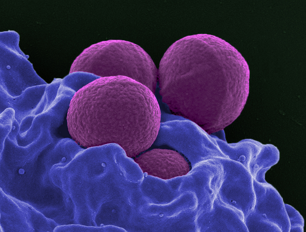 The MRSA superbug up close