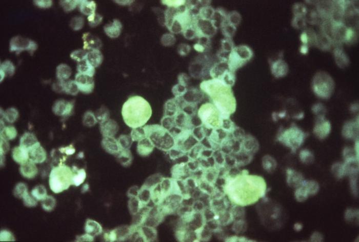 Cytomegalovirus (or CMV) as seen through a microscope