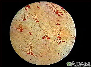 Organismo Salmonella typhi