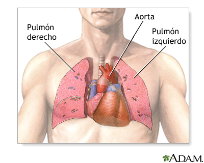 Trasplante de corazón y pulmón - serie - Anatomia normal