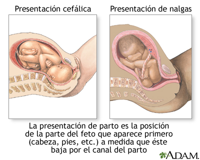 Presentaciones de parto