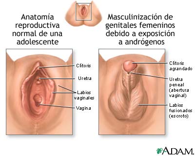 Trastornos en el desarrollo de la vagina y la vulva
