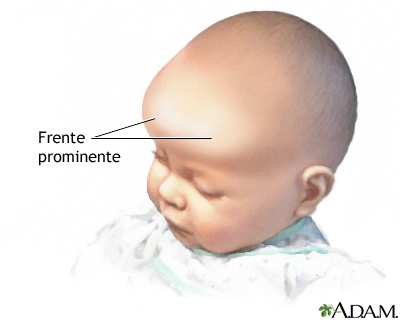 Protuberancia frontal