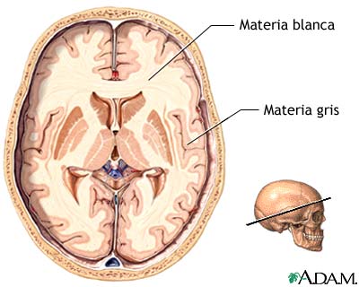 Materia gris y blanca del cerebro: MedlinePlus enciclopedia médica illustración
