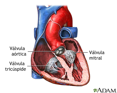 Cirugía de las válvulas cardíacas - Serie
