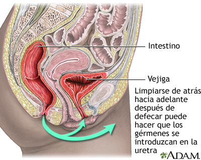 Velo soltar Yo Infección urinaria en adultos: MedlinePlus enciclopedia médica