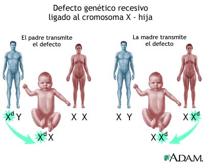 Defectos genéticos recesivos ligados al X - cómo se ven afectadas las niñas