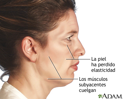 Cirugía estética facial - Serie - Indicaciones