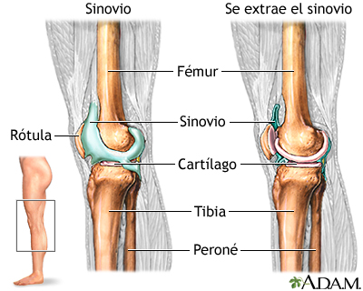 Glosario pistón Motivar Articulacin de la rodilla: MedlinePlus enciclopedia médica illustración