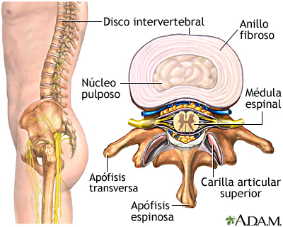 Disco intervertebral