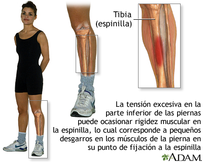 Conductividad Descompostura Del Norte Calambres en la pierna: MedlinePlus enciclopedia médica illustración