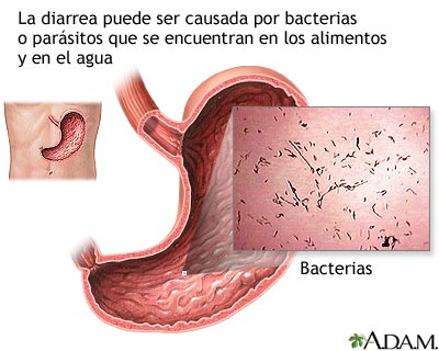 idioma Alentar Confusión Diarrea: MedlinePlus enciclopedia médica