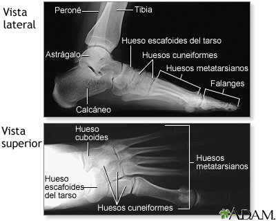 Radiografía del pie normal