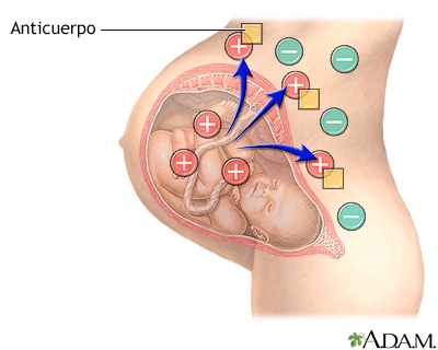 Si parte de la sangre del feto pasa al torrente sanguíneo de la madre, su cuerpo producirá anticuerpos en respuesta.