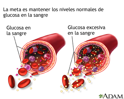 Glucosa en la sangre: MedlinePlus enciclopedia médica illustración