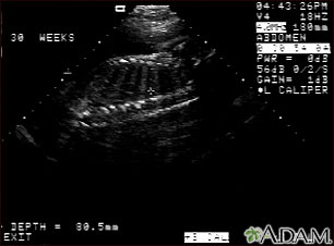 Ultrasonido de un feto normal - columna y costillas