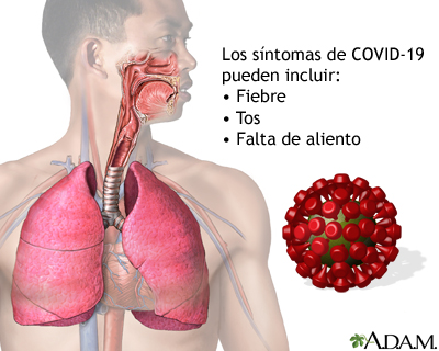 Enfermedad por coronavirus 2019 (COVID-19): MedlinePlus enciclopedia médica