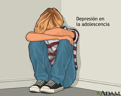 Depresión en el adolescente