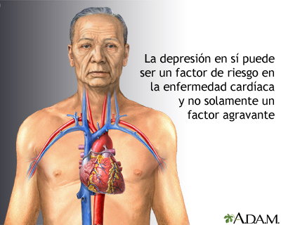 Depresión y enfermedad cardíaca