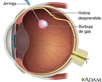 Procedimiento, parte 1