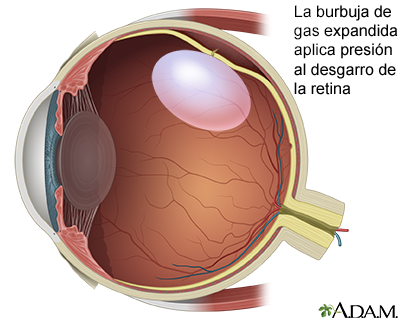 Procedimiento, parte 2