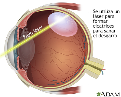 Procedimiento, parte 4