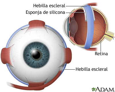 Procedimiento, parte 6