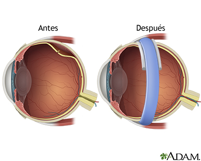 Cuidados posteriores