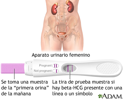 Prueba de embarazo