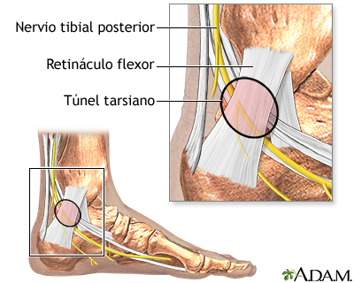 Túnel tarsiano