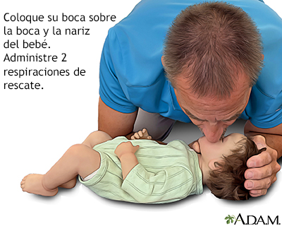 El bebé no respira