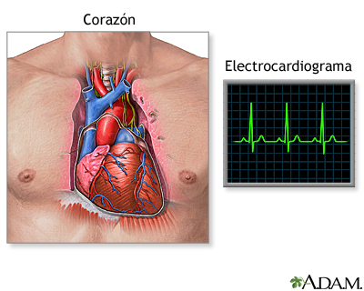 Monitorización y electrocardiograma en prono