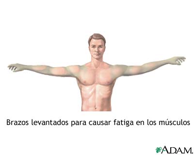 Fatiga muscular