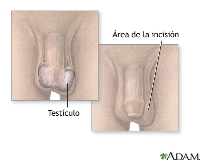 Biopsia testicular