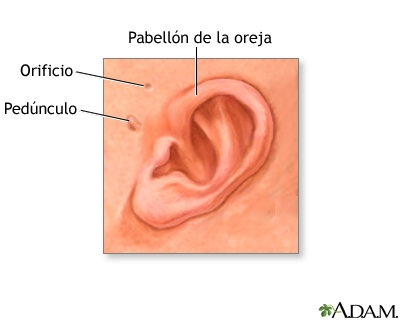 Anatomía de la oreja del recién nacido