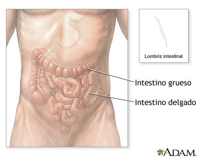 Lombrices intestinales