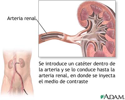 Arterias renales
