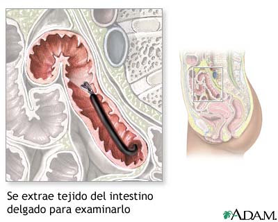 Muestra de tejido del intestino delgado