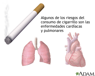 Riesgos de salud ocasionados por el tabaco