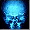 Granuloma eosinofílico - Radiografía del cráneo