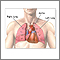 Trasplante de corazón y pulmón - serie - Anatomia normal